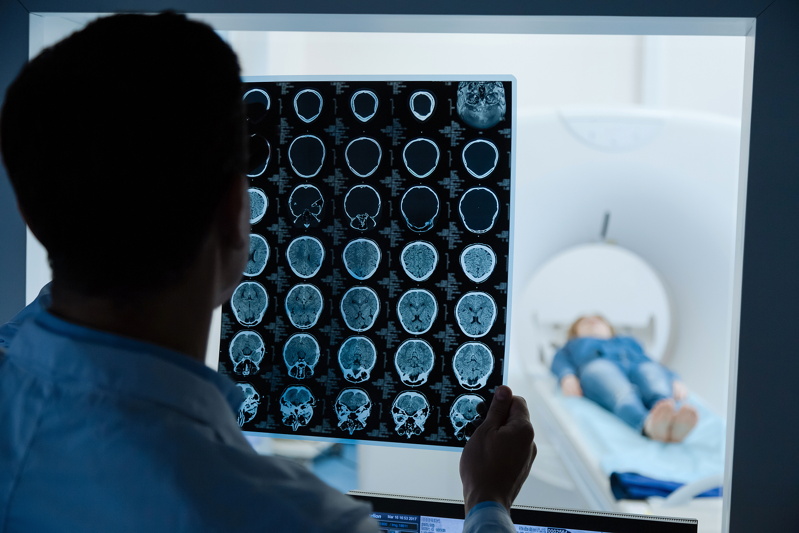 doctor holding a MRI scan images - doctor holding a MRI scan images